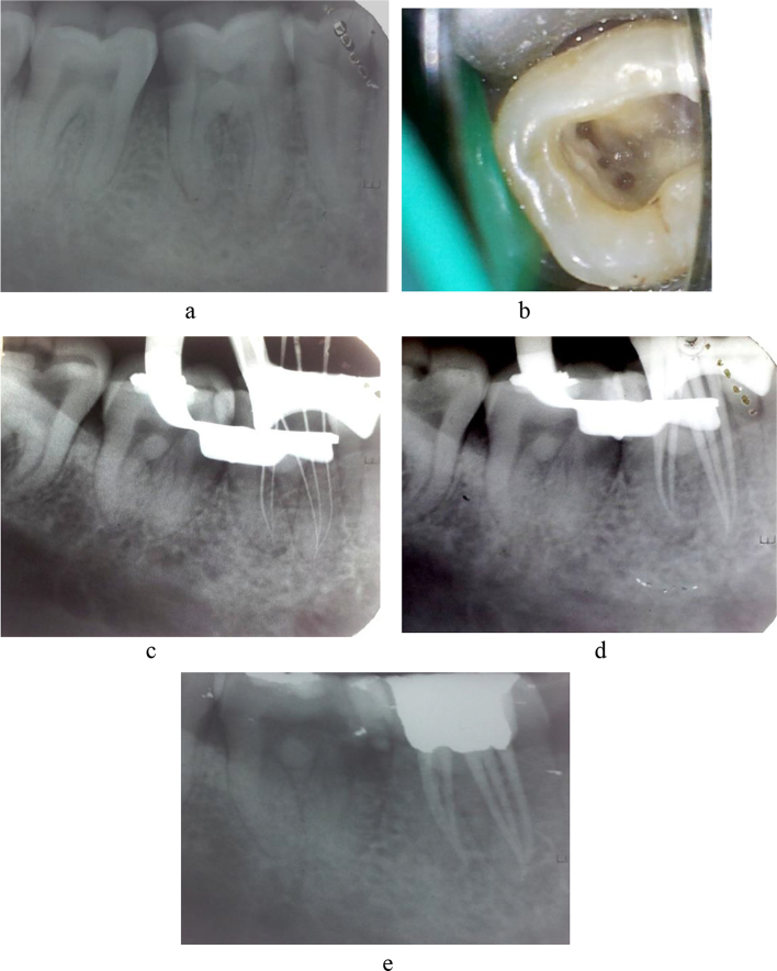 Fig. 1