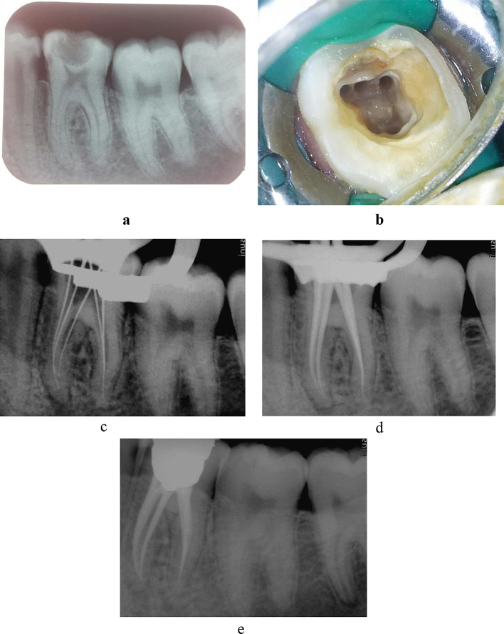 Fig. 2