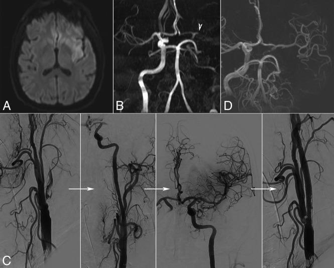 Fig 3.