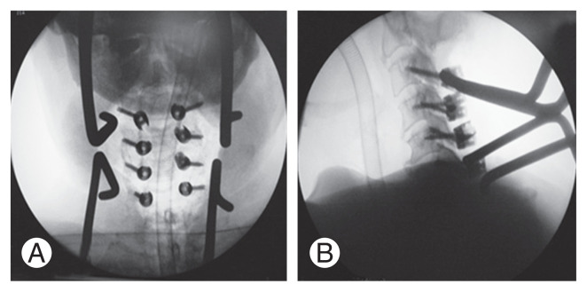 Fig. 4