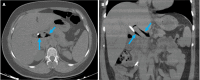 Figure 14