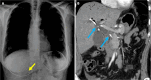 Figure 19
