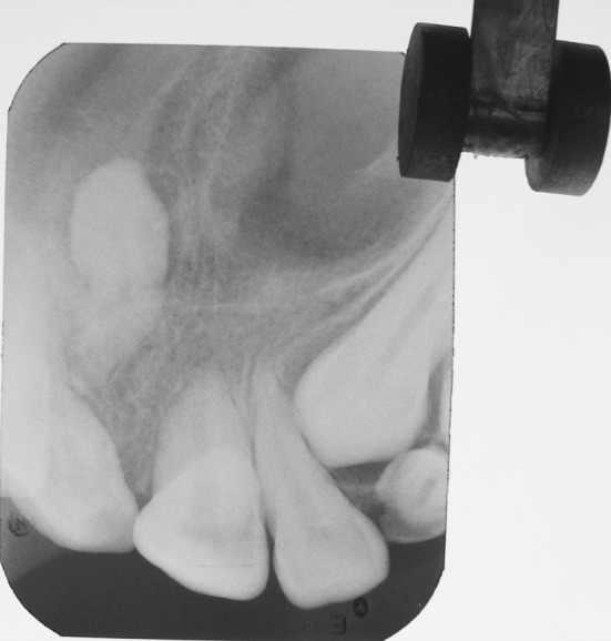 Fig. 4