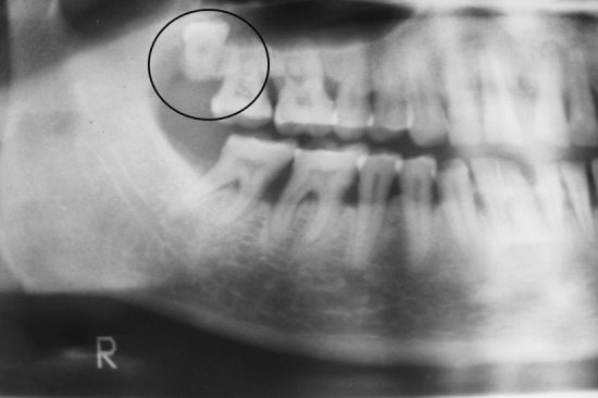 Fig. 1