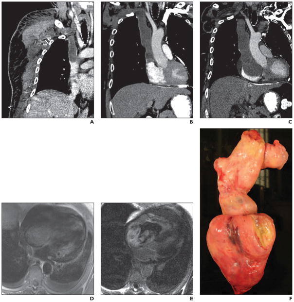 Fig 13