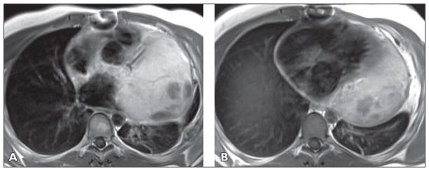 Fig 10