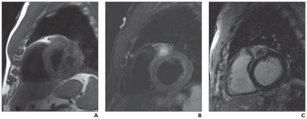 Fig 12