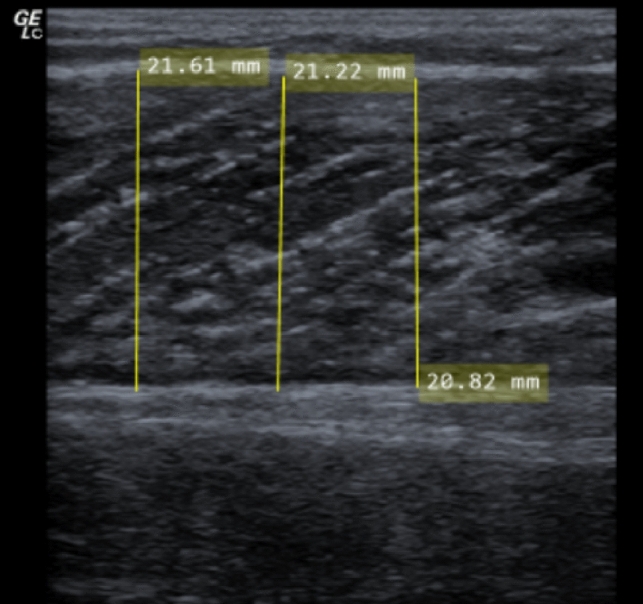 Fig. 2
