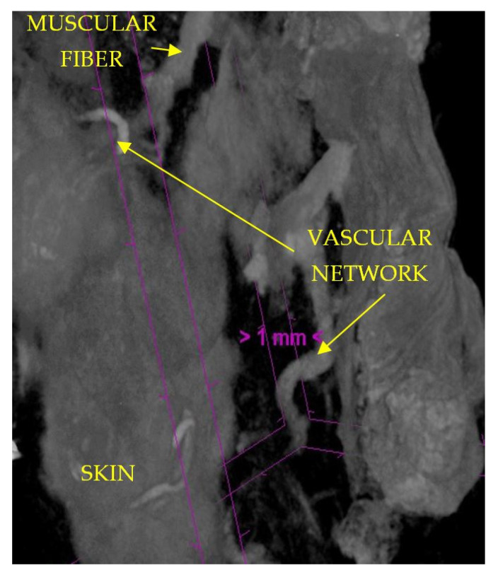 Figure 13