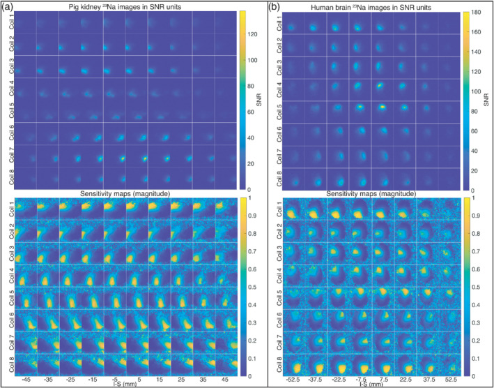 MRM-29259-FIG-0007-c