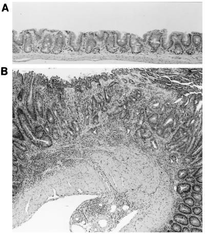 FIG. 6