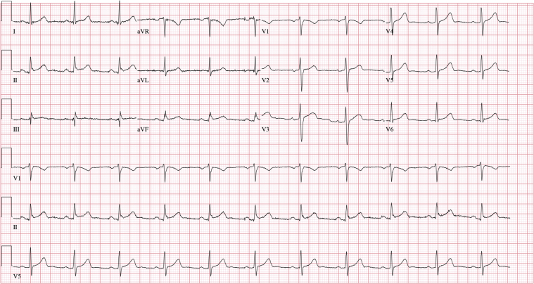 Figure 1