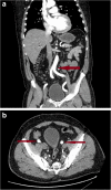 Fig. 3