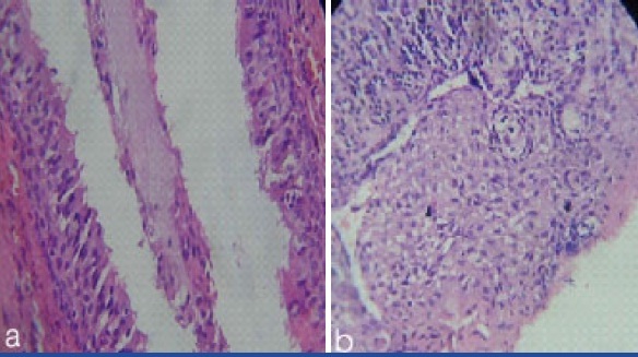 [Table/Fig-4a,b]: