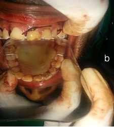 [Table/Fig-3b]: