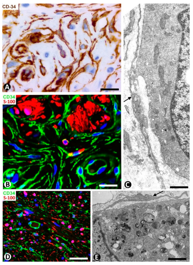 Figure 17