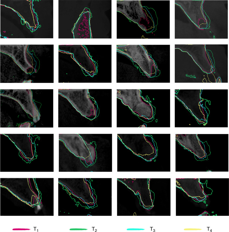 Fig. 4