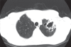 Figure 2)