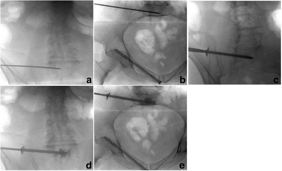 Fig. 2