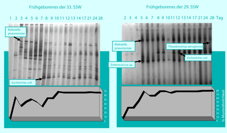 graphic file with name 978-3-642-24710-1_30_Fig4_HTML.jpg