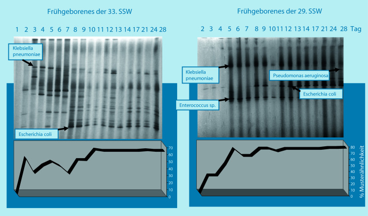 graphic file with name 978-3-642-24710-1_30_Fig4_Print.jpg