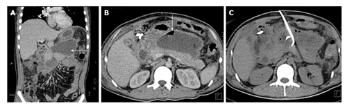 Figure 14