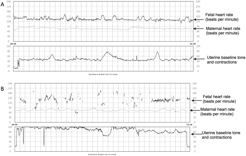 Fig 4