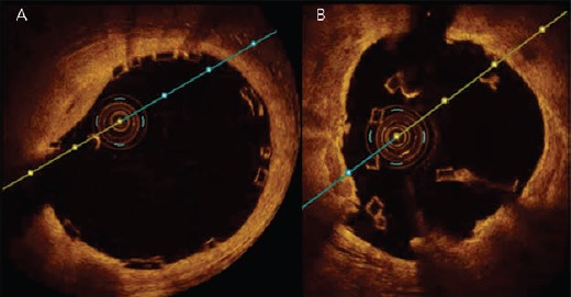 Figure 2: