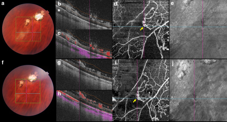 Fig. 2