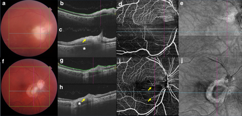 Fig. 1