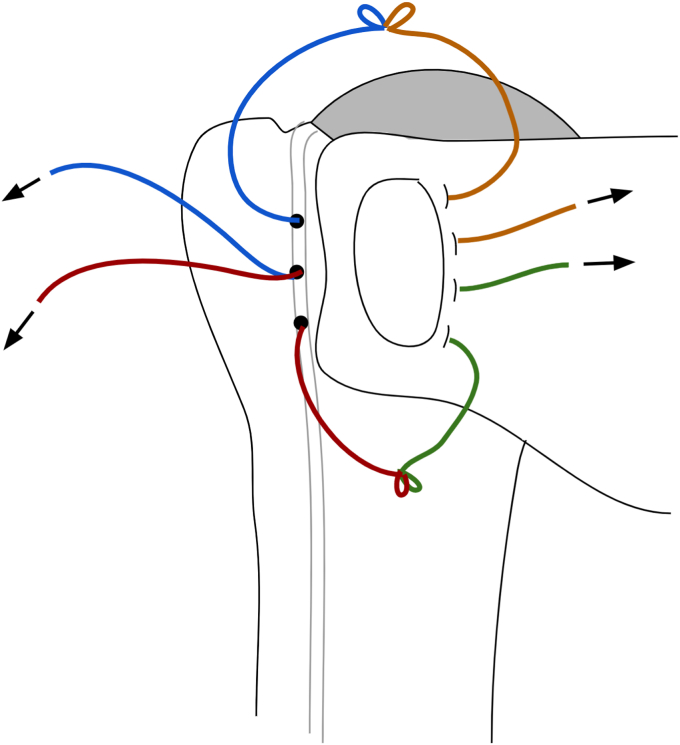 Figure 10