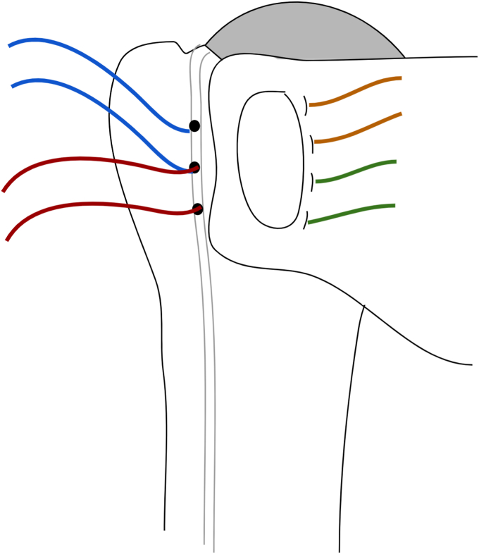 Figure 9