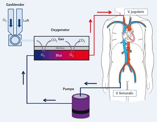 graphic file with name 398_2012_984_Fig2_HTML.jpg