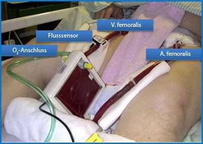 graphic file with name 398_2012_984_Fig5_HTML.jpg