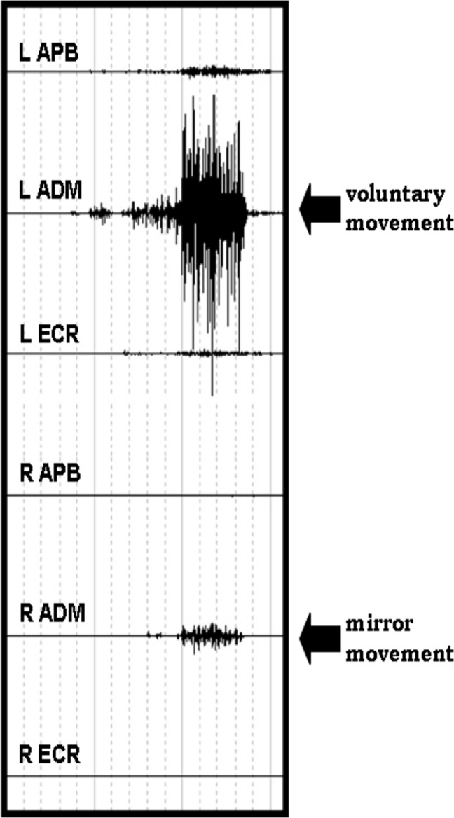 Fig 1