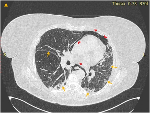 Fig. 1