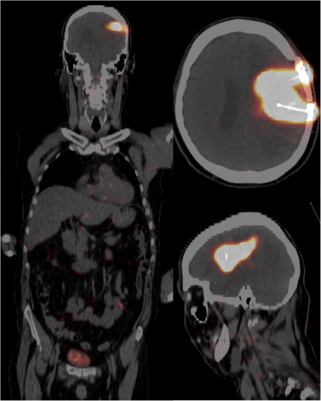 Fig. 2