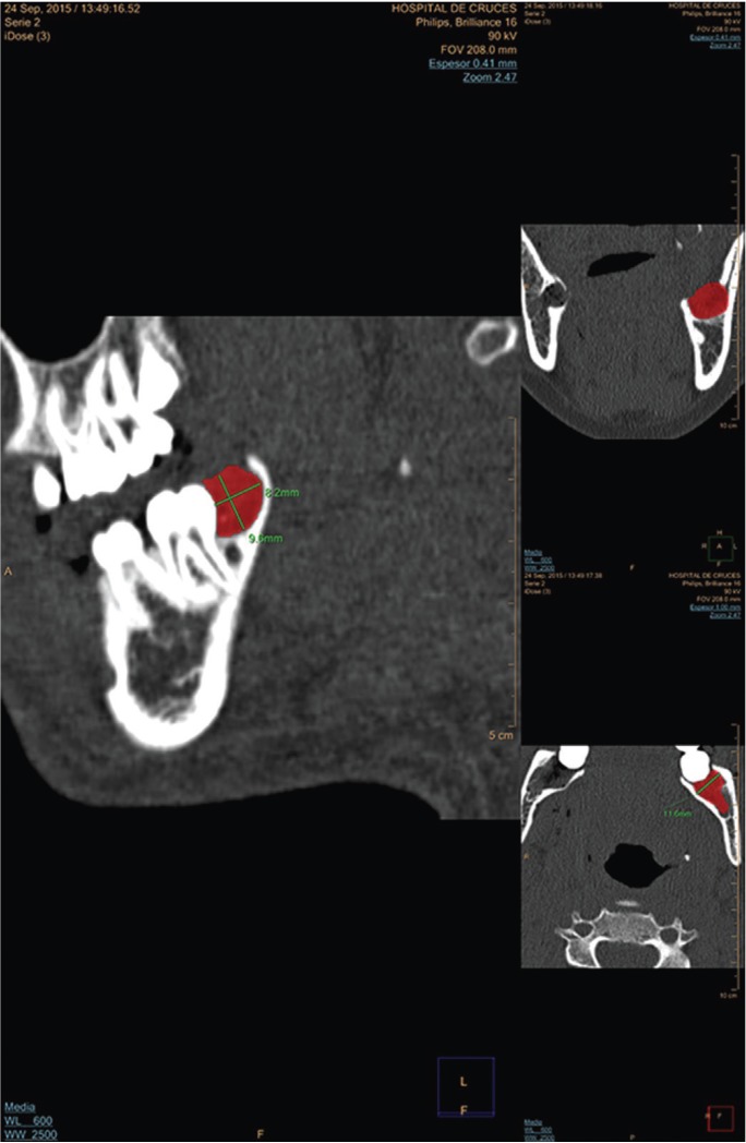 Figure 2