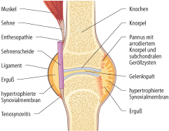 graphic file with name 978-3-662-57295-5_12_Fig1_HTML.jpg
