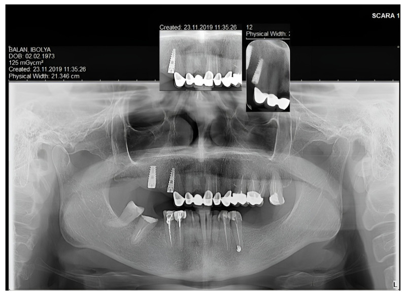 Figure 7