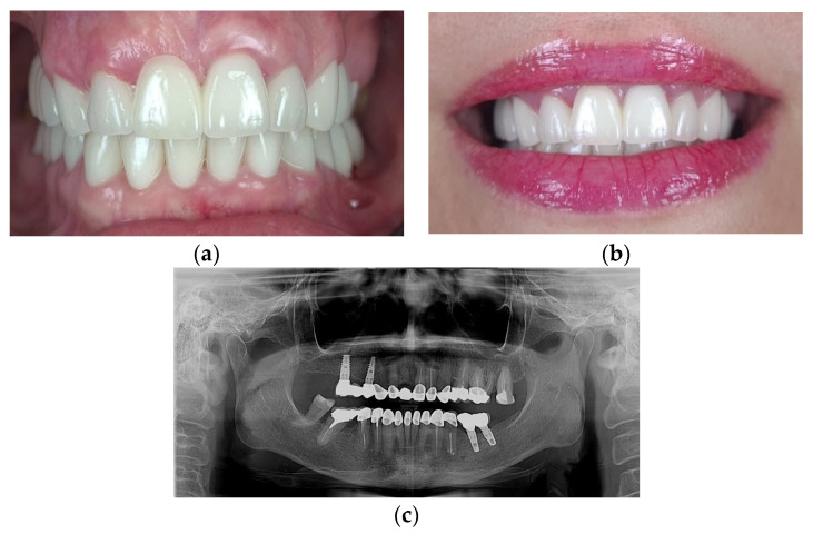 Figure 12