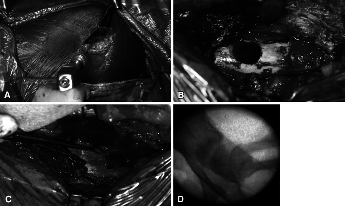 Fig. 1A–D