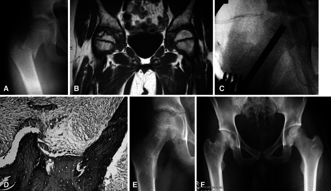 Fig. 3A–F