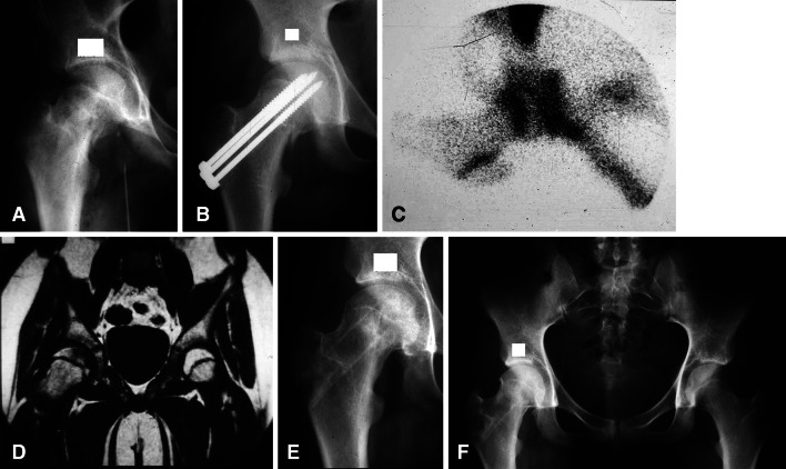 Fig. 2A–F