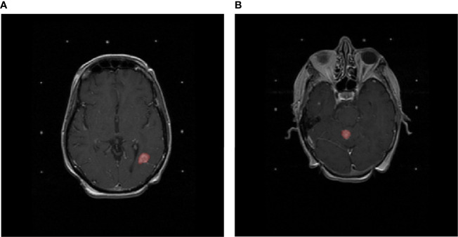 Figure 1