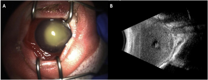 Fig. 5