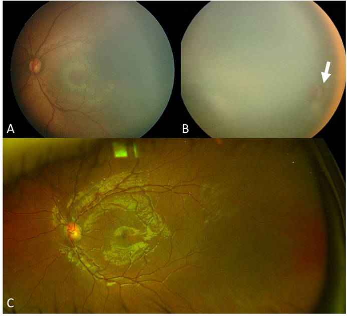 Fig. 3