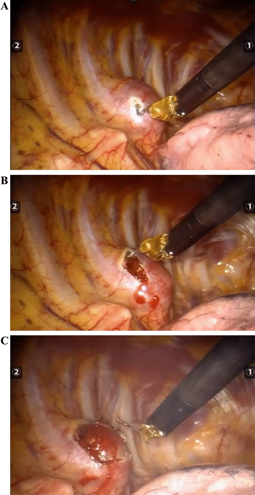 Fig. 3