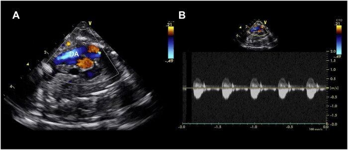 FIGURE 4