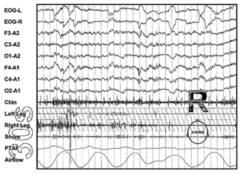 Fig. 2